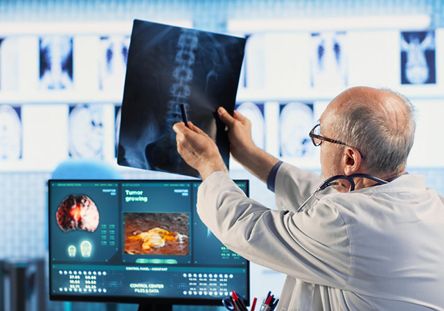 Digital X-Ray