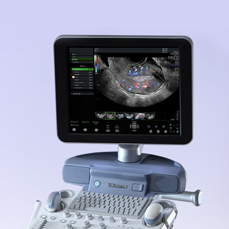 Voluson P8 Core